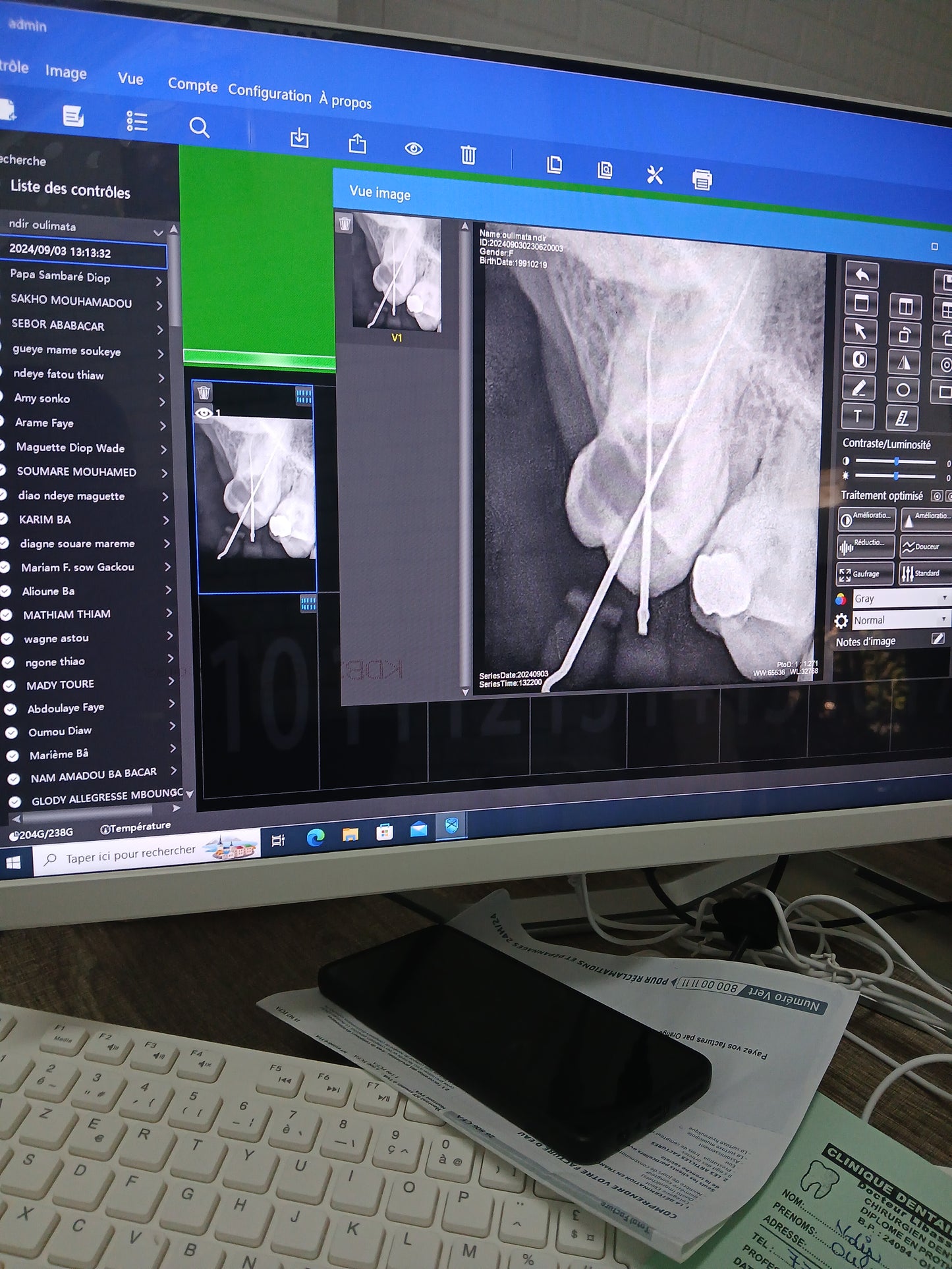 Dental X-Ray with RVG sensor