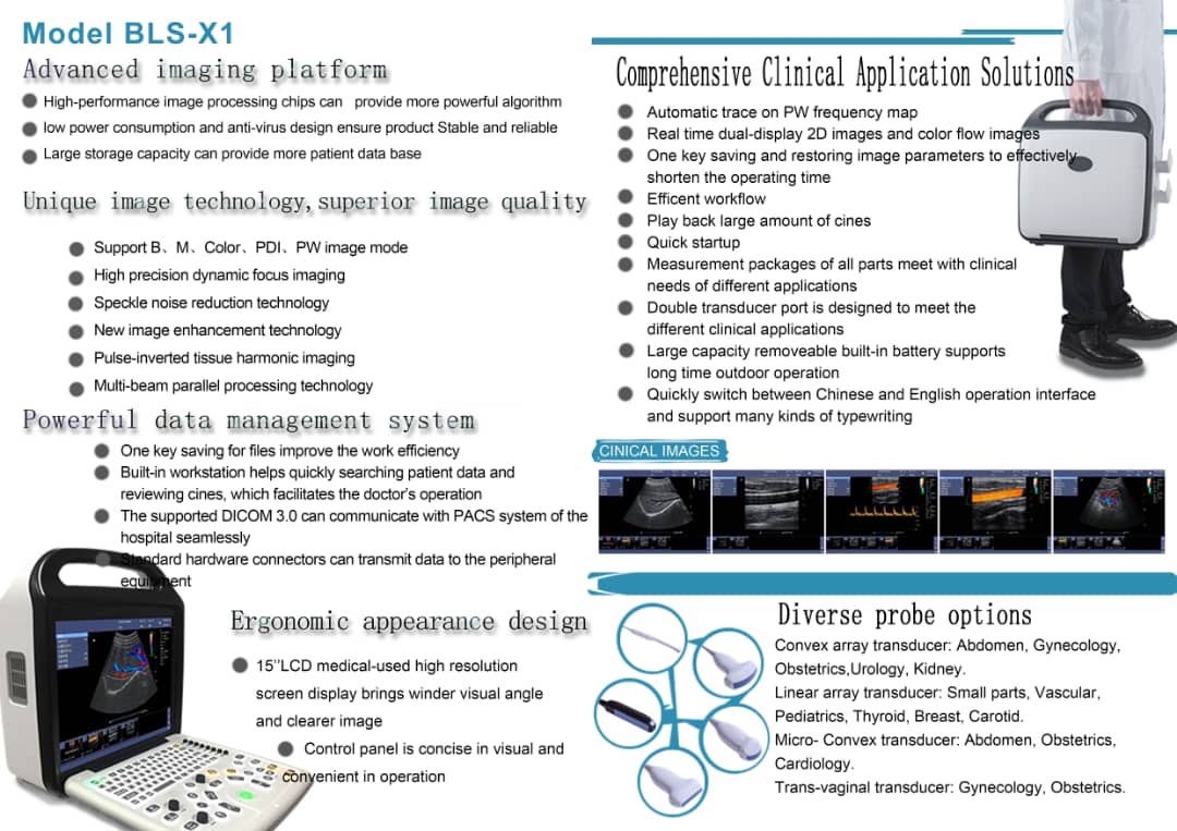 BELSE X1 color doppler ecograph . Cardiac probe .
