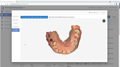 Shining 3D oral scan 3