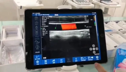 This sytle also is 3 in 1, and the Probe element:128
Display mode: B, B/M, Color doppler version with B+Color, B+PDI, B+PW. This style can check cardiac   effect. 3 in 1: Convex+Cardiac +Linear.   Ultra portable ecograph