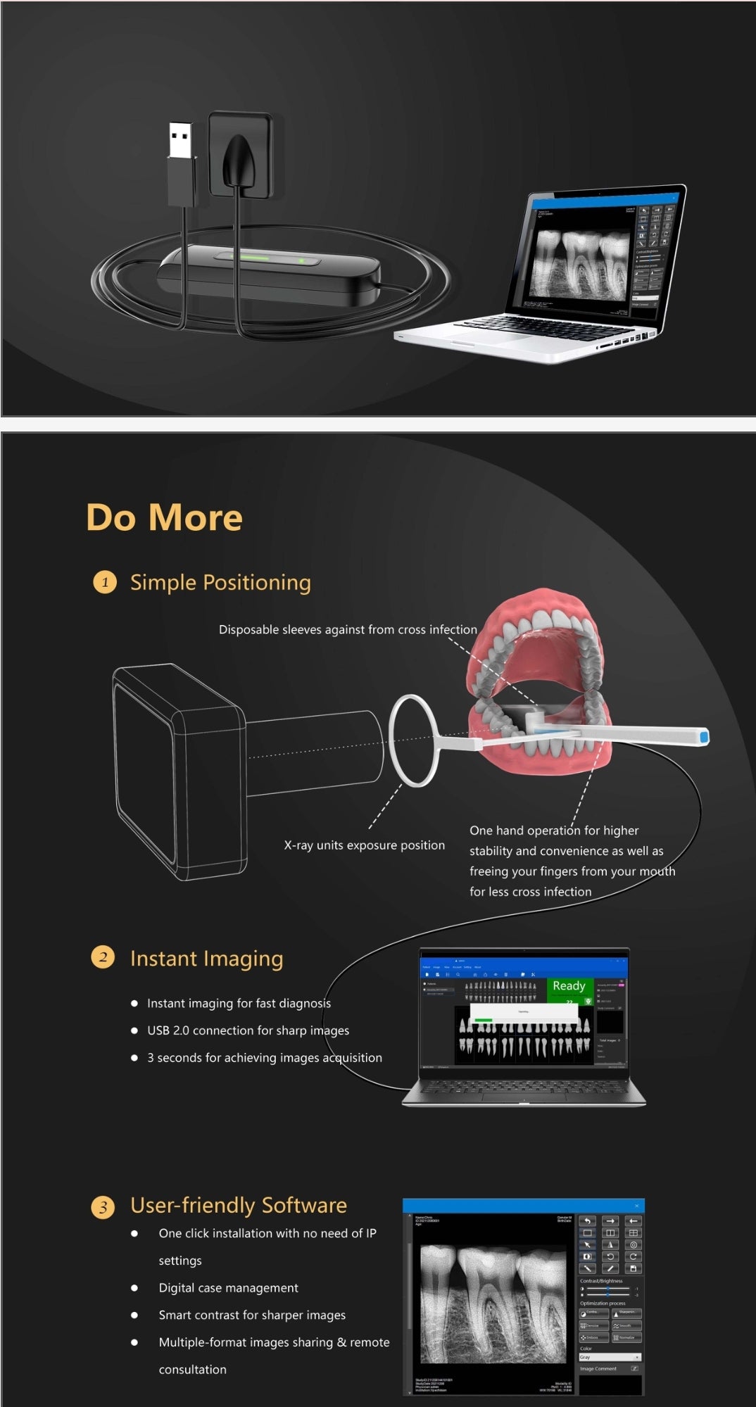 Dental RVG SENSOR  XV SENSOR