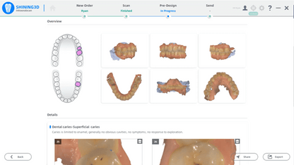 Shining 3D oral scan 3