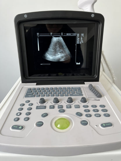 ##ecographe ##12inch BW ultrasound machine . With convex probe and batterie