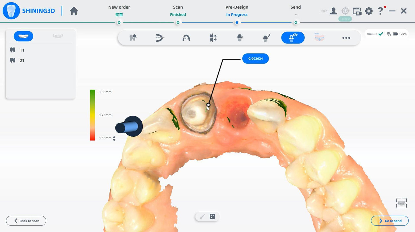 (Copie) wireless dental 3D scanner,   shining 3D wireless,  oral scan